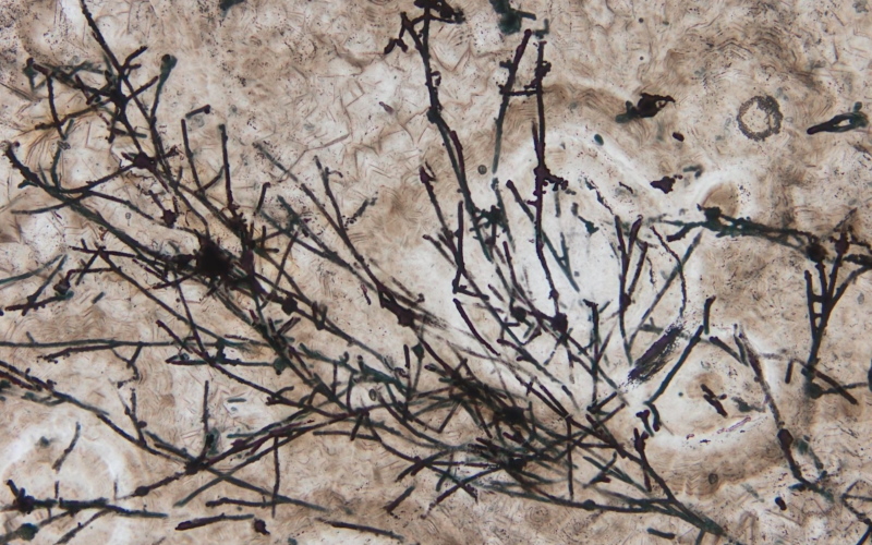 Микроскопическое изображение грибовидных нитевидных микроокаменелостей.