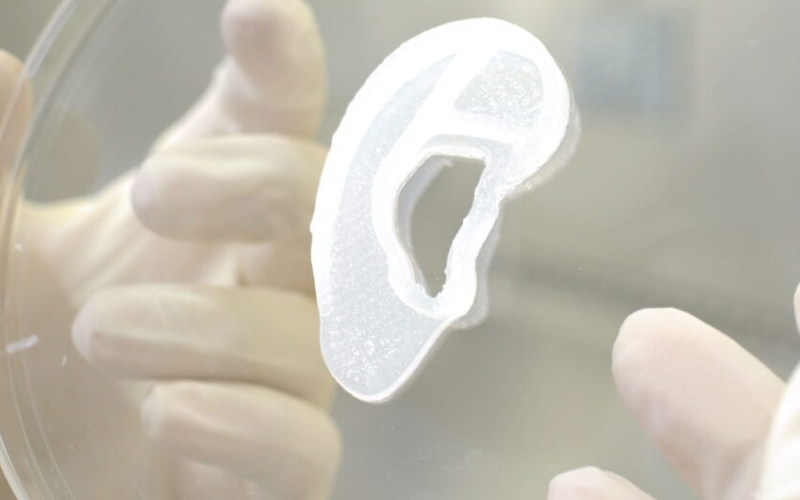 Напечатанное на 3D-биопринтере ухо, выращенное из собственных хрящевых клеток пациента.