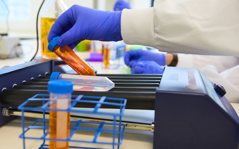 Глядя на определенные белки в биопсии опухоли, новый тест может измерить риск распространения или рецидива меланомы.