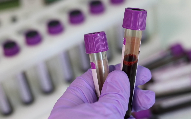 Анализ крови PanSeer может выявить пять различных типов рака.