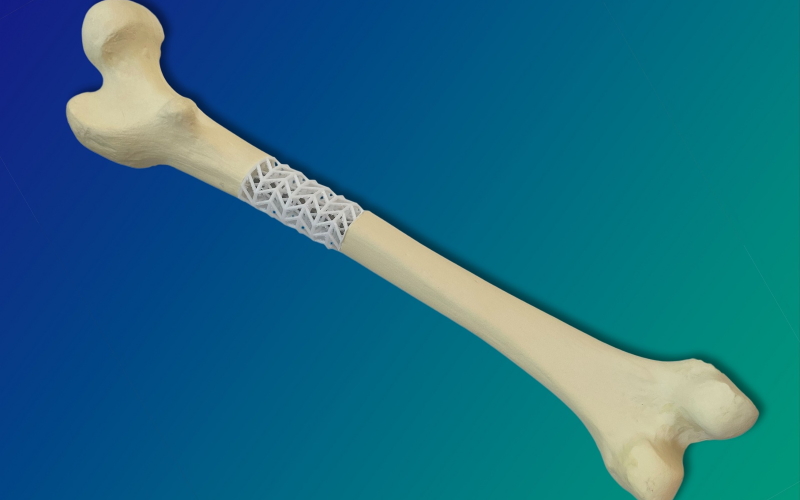 На этом изображении показано, как этот материал можно использовать для временного замещения отсутствующей кости в месте перелома.