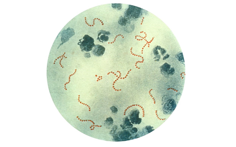 Бактерии стрептококка из группы А - Streptococcus pyogenes - при 900-м увеличении.